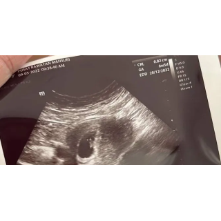 Rawatan Islam Ikhtiar Hamil