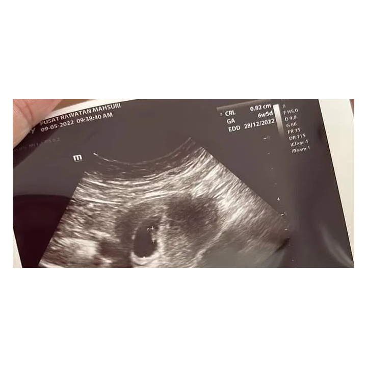 Rawatan Islam Ikhtiar Hamil