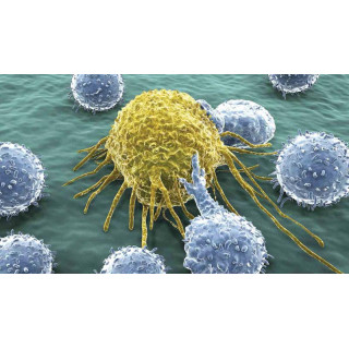 Rawatan Kanser Perubatan Islam