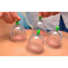Cupping Therapy (Bekam)